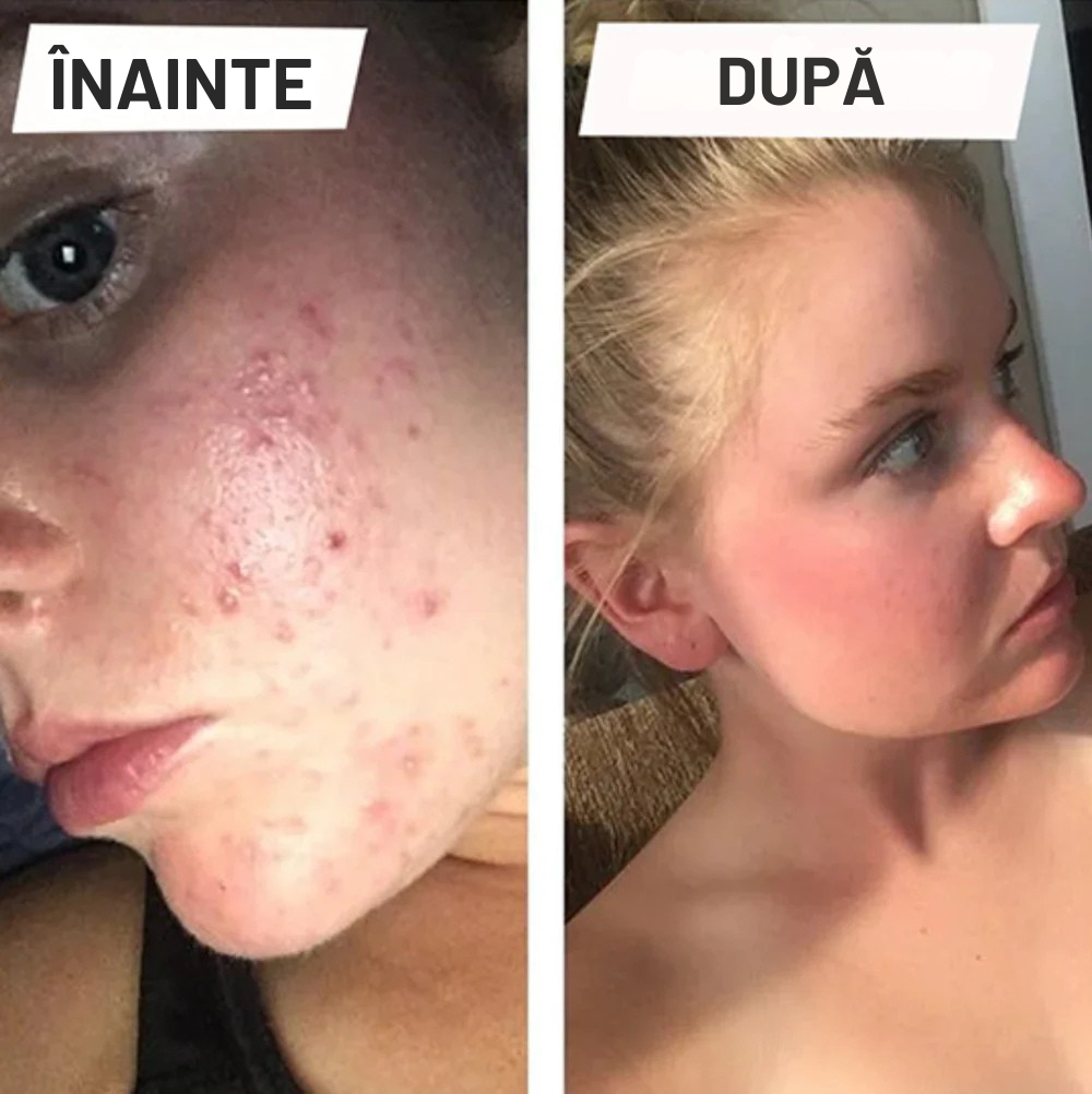 Flawless™  SkinFace  - Aparat Pentru Curatarea Si Masarea Tenului