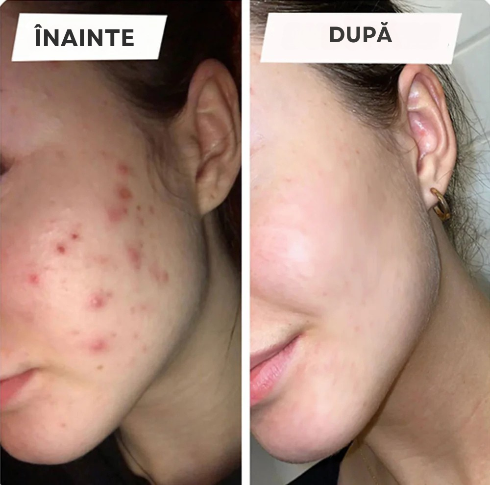 Flawless™  SkinFace  - Aparat Pentru Curatarea Si Masarea Tenului