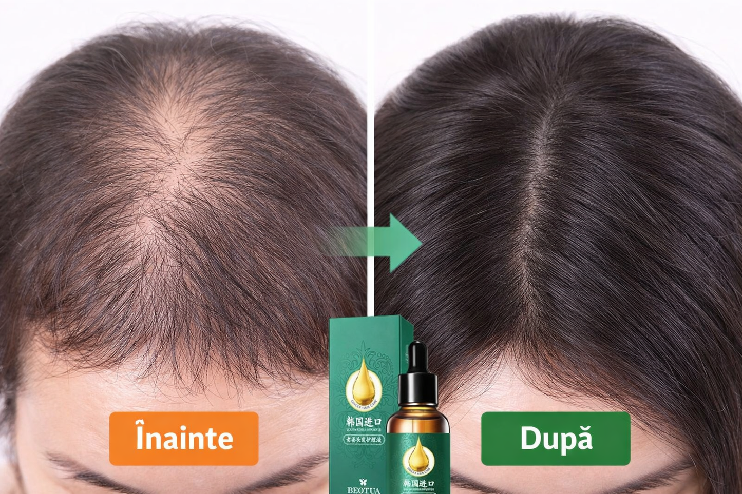 Ulei esential Korean pentru par cu radacina de Ghimbir BEOTUA – crestere accelerata, hidratare si stralucire